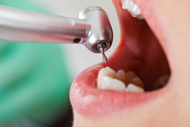 Best Emergency Treatment for Toothache in Shattuck, OK